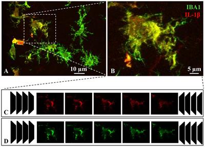 Microglial Morphometric Parameters Correlate With the Expression Level of IL-1β, and Allow Identifying Different Activated Morphotypes